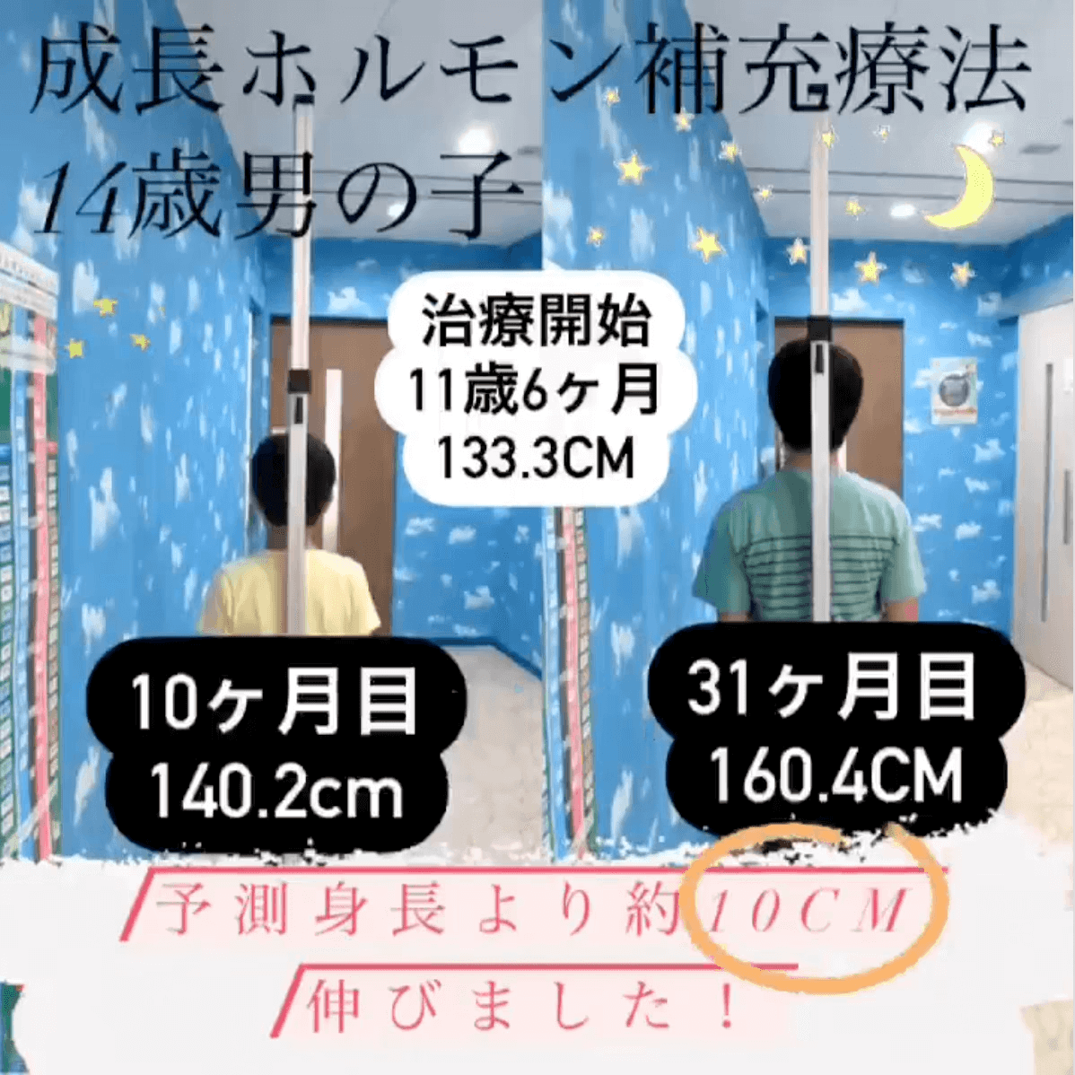 症例１