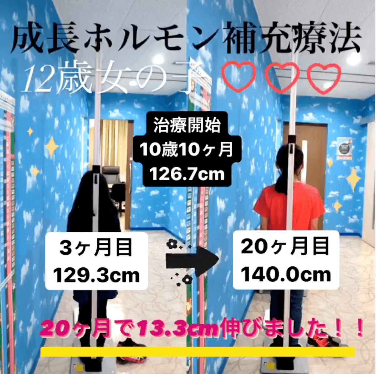 症例２