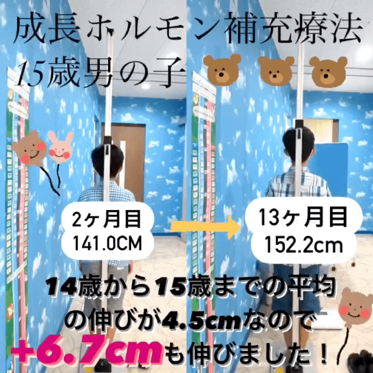 症例3