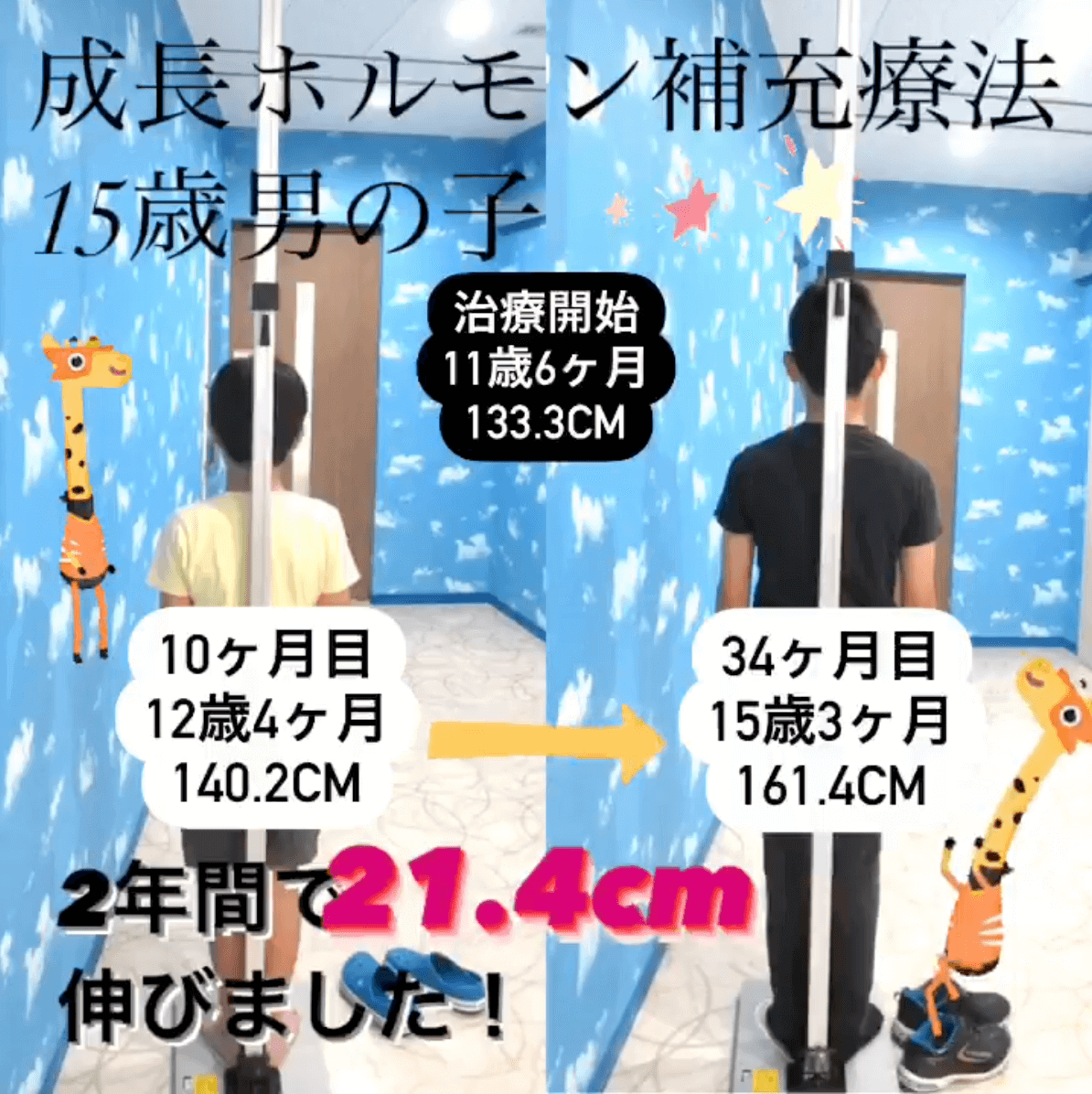 症例4